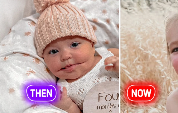 She Had The World's Rarest Condition.  But When You See Her Today, You Won't Believe Your Eyes!